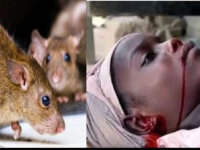 Be careful: there’s an outbreak of Lassa fever in Nigeria